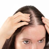 髪の脱毛・薄毛対策 - ウチワサボテンオイル - NECTAROME ネクタローム