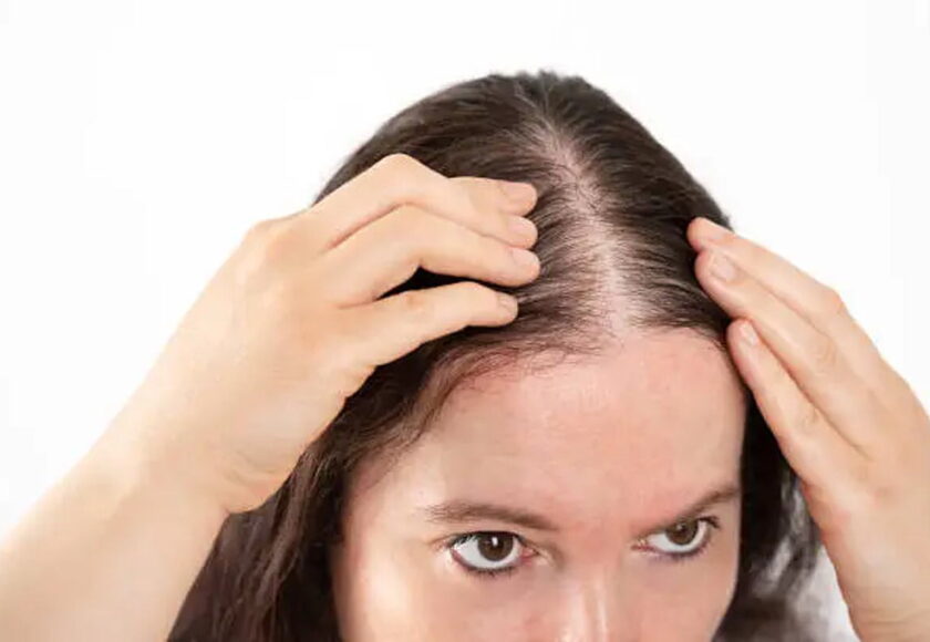 髪の脱毛・薄毛対策 - ウチワサボテンオイル - NECTAROME ネクタローム